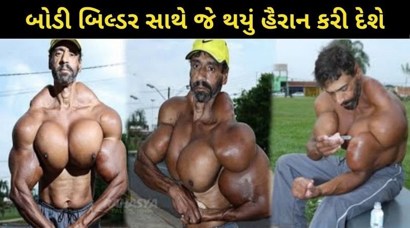 હલ્ક ના નામથી ફેમસ બોડી બિલ્ડર સાથે જે થયું હૈરાન કરી દેશે, ઝડપથી બોડી બનાવતા લોકો માટે ચેતવણીરૂપ કિસ્સો...