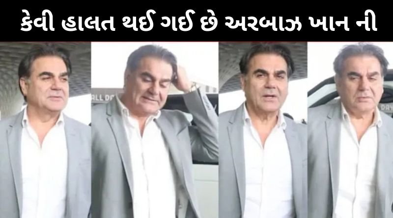 કેવી હાલત થઈ ગઈ છે સલમાનના નાના ભાઈ અરબાઝ ખાનની, ઓળખવા મુશ્કેલ બન્યા...
